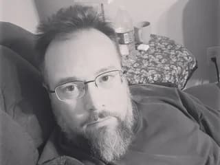 WebCAM of Allergictocam